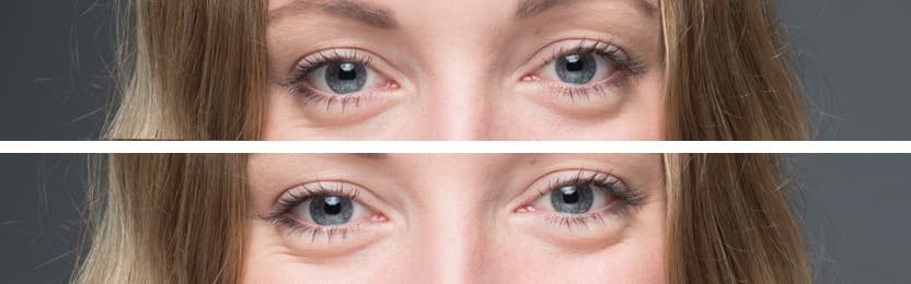 Louise Eyes